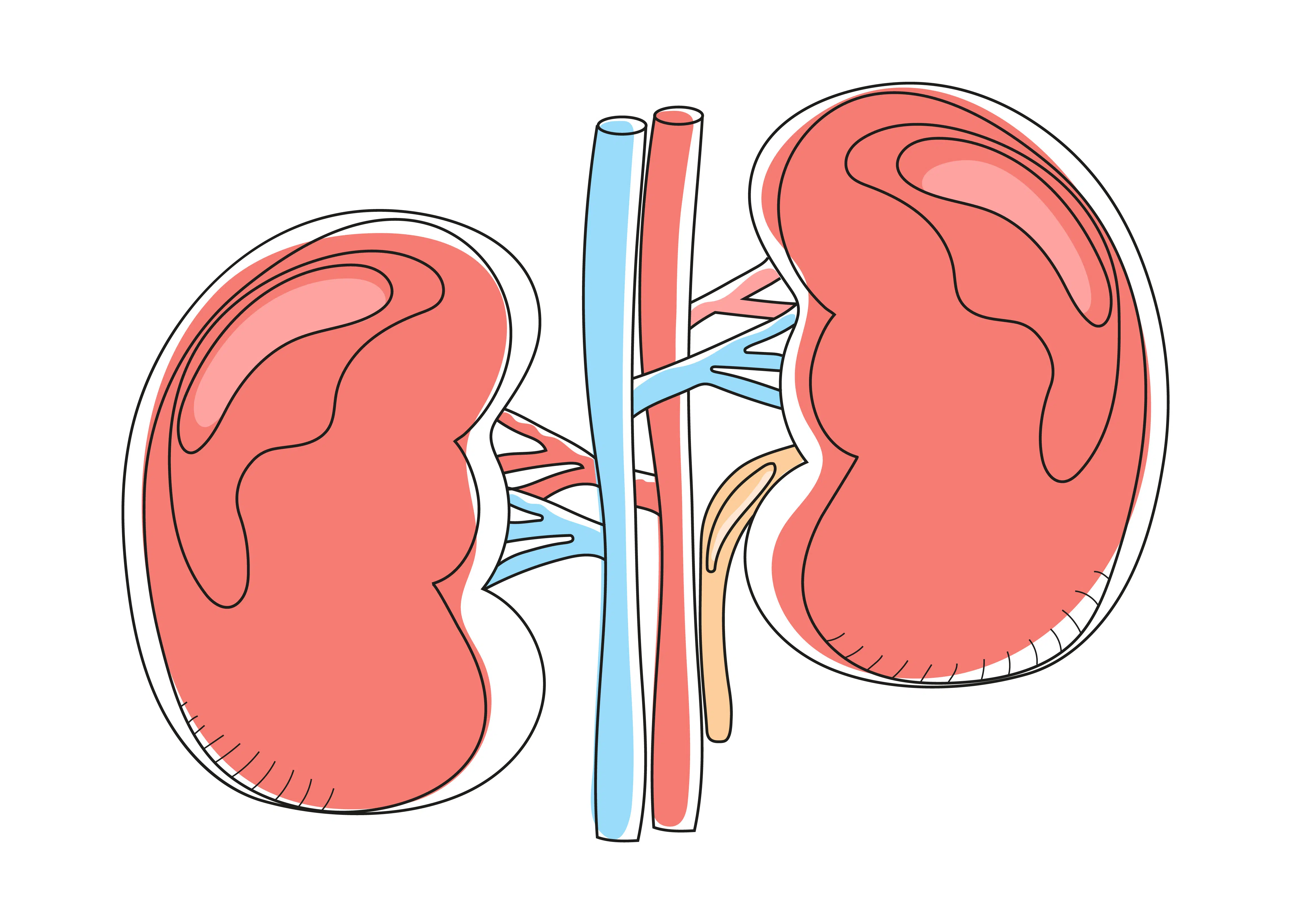 Maladie rénale chronique