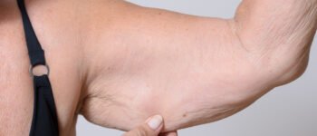 Masse musculaire après 35 ans : comment éviter la fonte ?