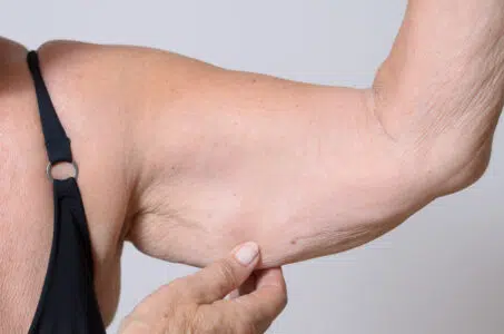 Masse musculaire et âge