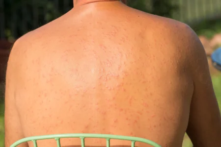 Notre blog 21 lucite estivale