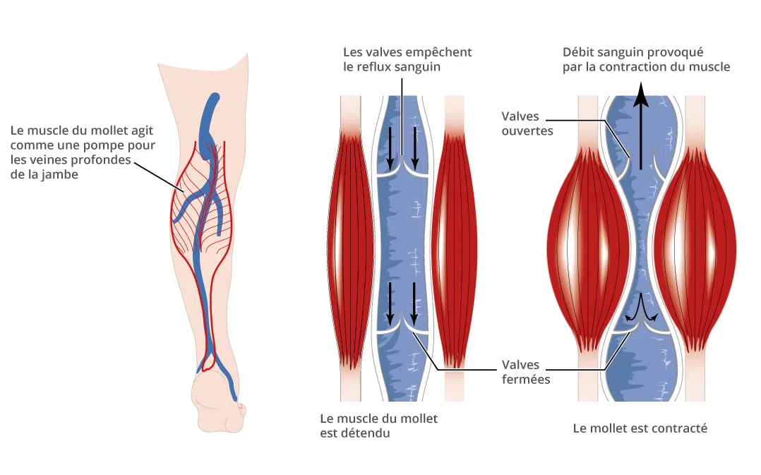 Sport pour lutter contre les varices