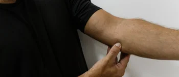 Épitrochléite(Golfer&rsquo;s Elbow) : symptômes, causes, traitements et prévention